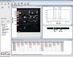 Sistema de documentación de geles microDOC con transiluminador UV